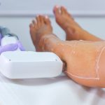 consejos post-tratamiento laser diodo