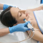 Hydrafacial tratamiento